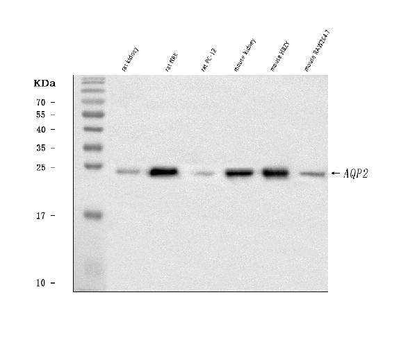 Western blot analysis of Aquaporin 2 using anti-Aquaporin 2 antibody (PB9474).