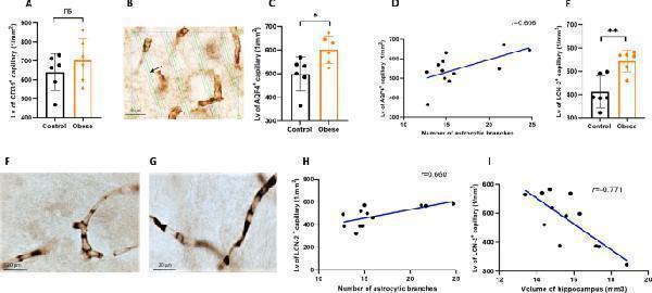 Effects of maternal obesity on the hippocampal vascularization and coverage of capillaries by end-feet of astrocytes in offspring: no significant difference in the length density of CD31 + capillaries between two groups of mice ( A ); an example of the length density of AQP4 + capillaries measurement