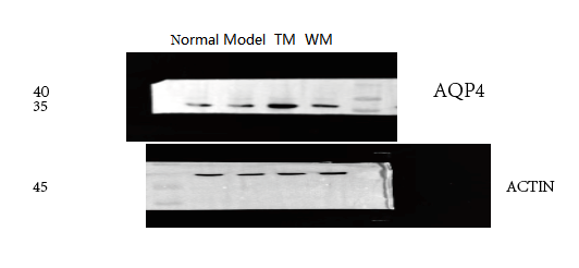 pb9475 aqp4 primary antibodies wb testing 3