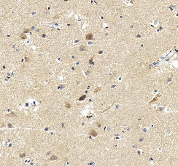 pb9476 aplp1 primary antibodies ihc testing 4