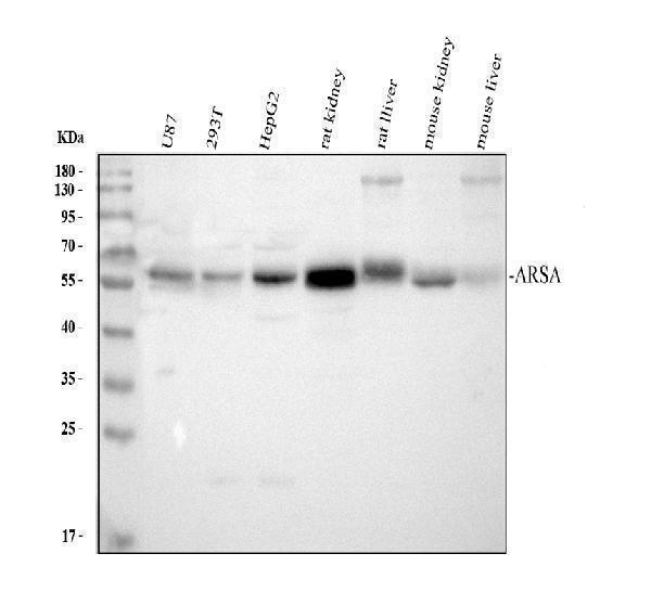 Western blot analysis of ARSA using anti-ARSA antibody (PB9477)