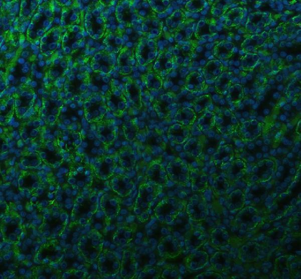 pb9482 atp1a1 primary antibodies if testing 2