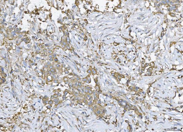 pb9483 atxn2 primary antibodies ihc testing 2