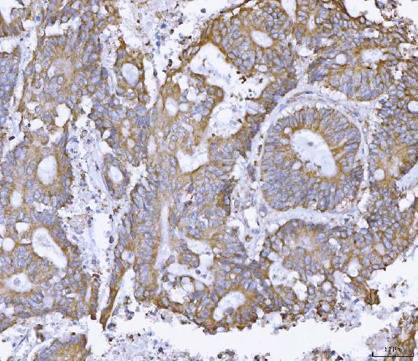 pb9483 atxn2 primary antibodies ihc testing 3
