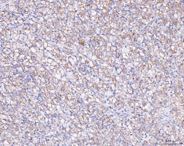 pb9483 atxn2 primary antibodies ihc testing 4