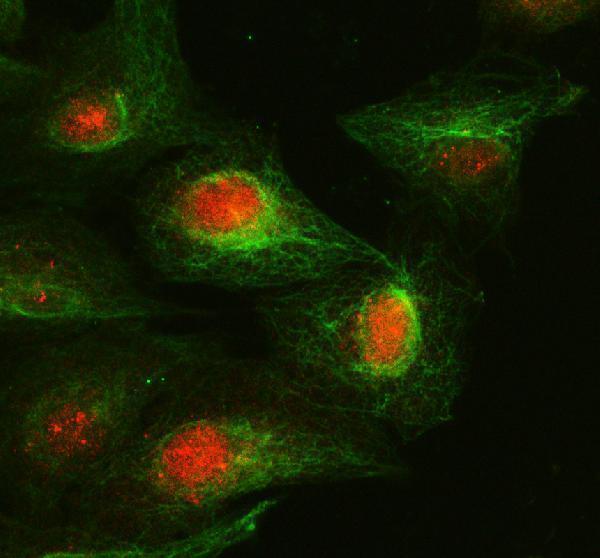 pb9485 ccna1 primary antibodies if testing 2_1