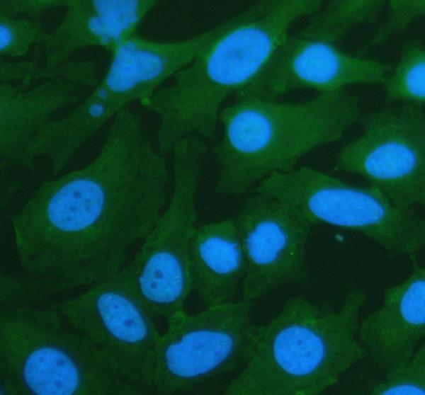 pb9486 cd46 primary antibodies if testing 1