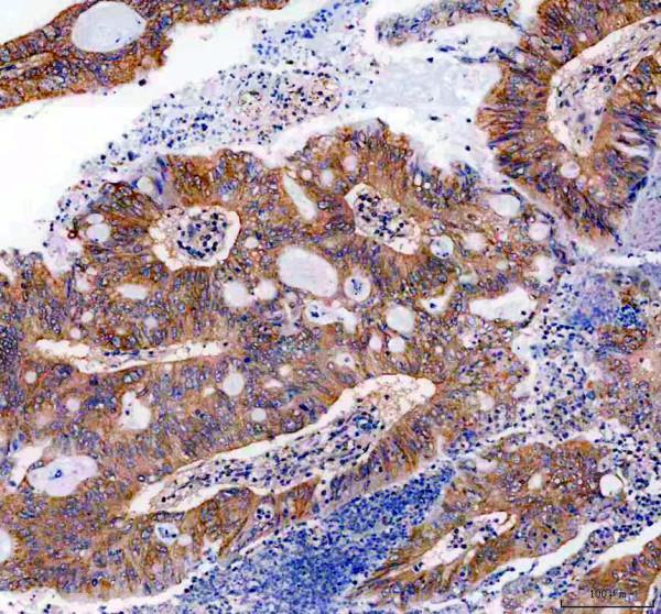pb9486 cd46 primary antibodies ihc testing 1