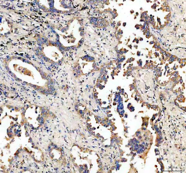 pb9486 cd46 primary antibodies ihc testing 2_1