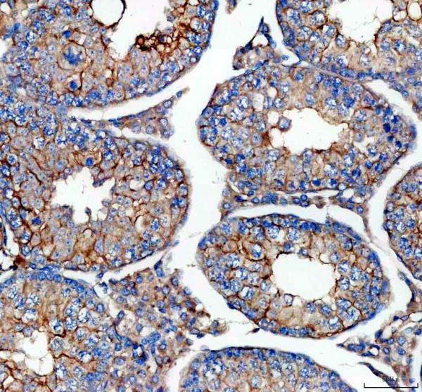 pb9486 cd46 primary antibodies ihc testing 3_1