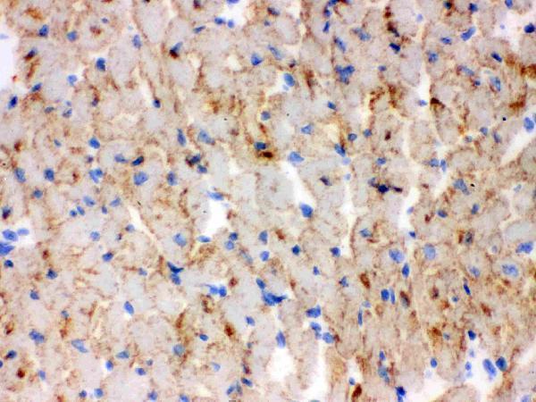 pb9491 cpt1b primary antibodies ihc testing 4