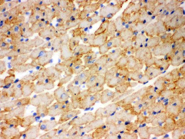 pb9491 cpt1b primary antibodies ihc testing 5