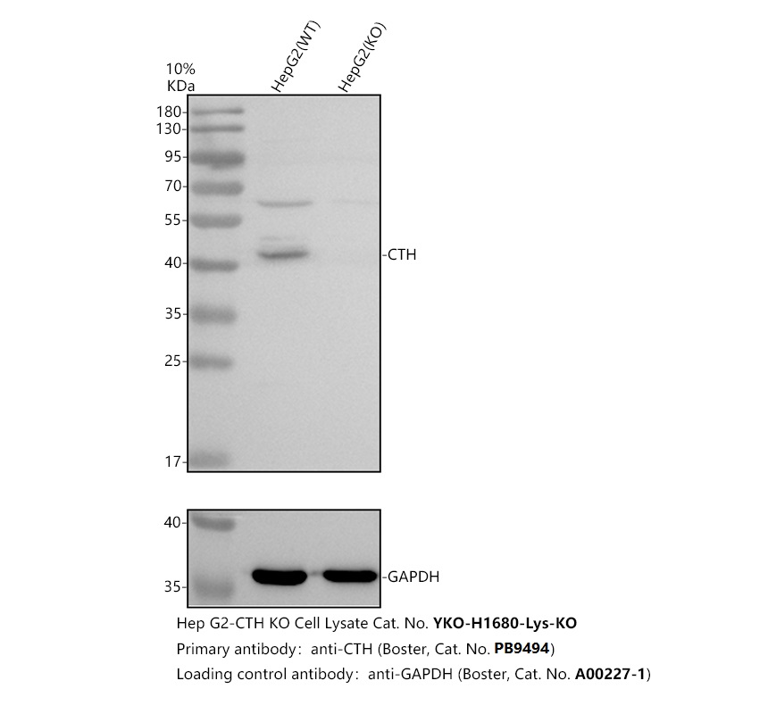Western blot analysis of Gamma Cystathionase/CTH using anti-Gamma Cystathionase/CTH antibody (PB9494)