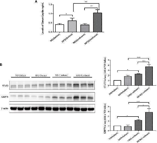 The expression of leptin in serum and target protein expression in lung tissues of C57BL/6J mice