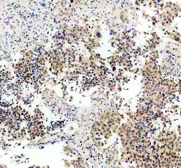 pb9511 stat3 primary antibodies ihc testing 1