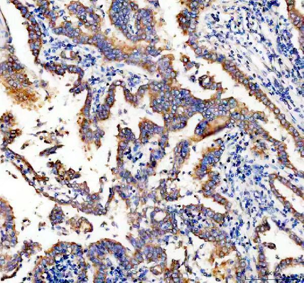 pb9513 sting1 primary antibodies ihc testing 1