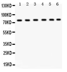 Anti-TRPV5 Antibody Picoband&reg;