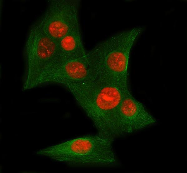 pb9520 xrcc6 primary antibodies if testing 16