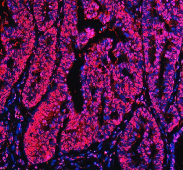 pb9520 xrcc6 primary antibodies if testing 17