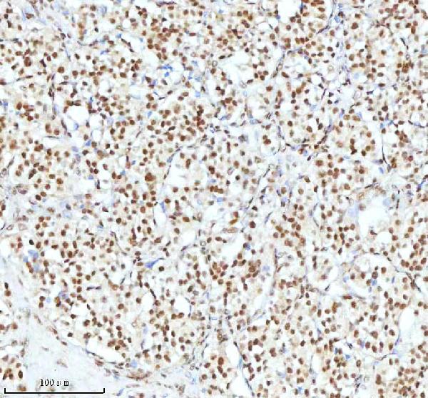 pb9520 xrcc6 primary antibodies ihc testing 11