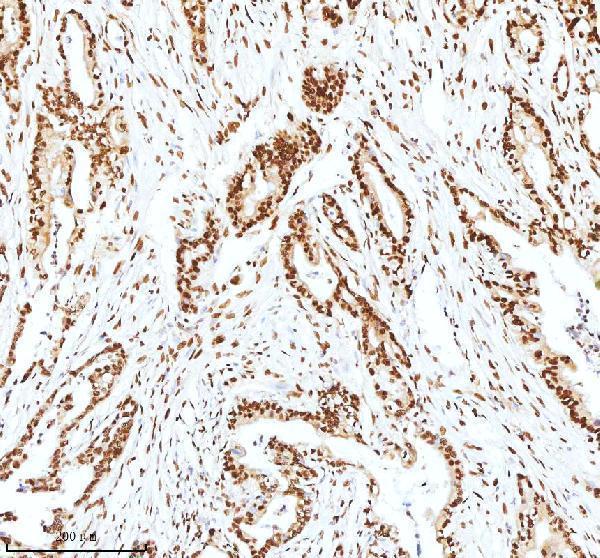 pb9520 xrcc6 primary antibodies ihc testing 12