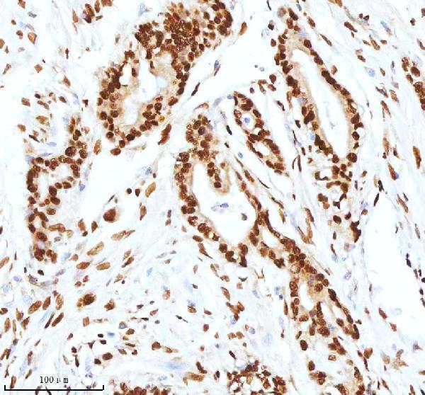 pb9520 xrcc6 primary antibodies ihc testing 13