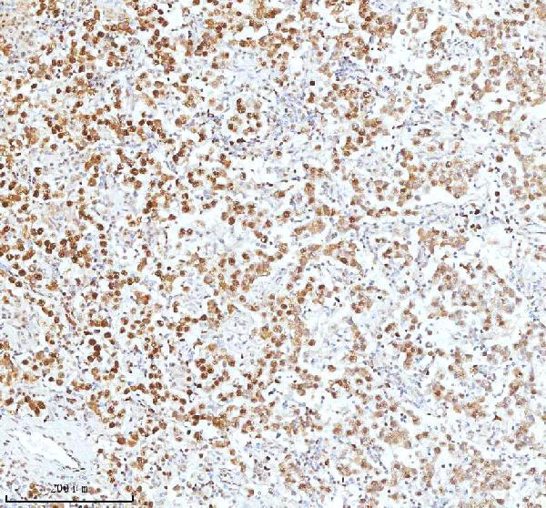 pb9520 xrcc6 primary antibodies ihc testing 14