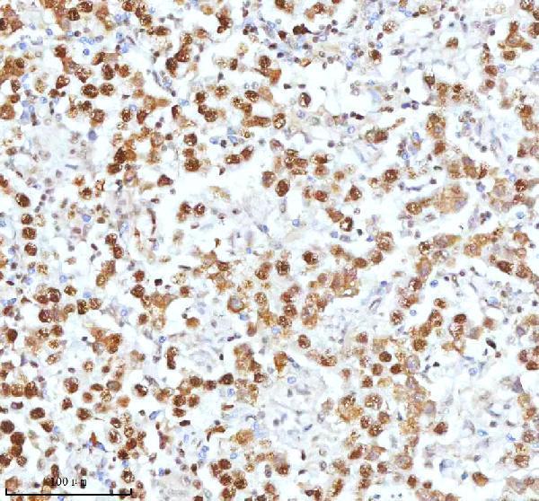 pb9520 xrcc6 primary antibodies ihc testing 15