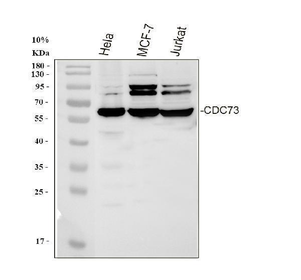  Western blot analysis of HRPT2/CDC73 using anti-HRPT2/CDC73 antibody (PB9532)