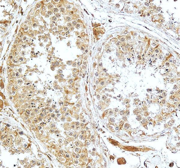 pb9540 cry1 primary antibodies ihc testing 5