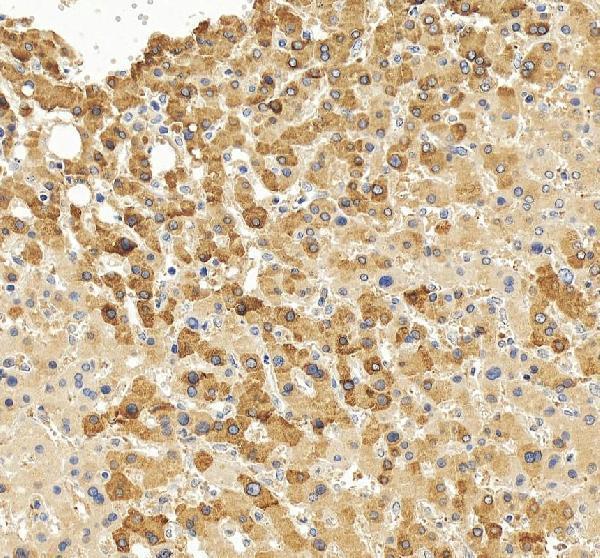 IHC analysis of CYP1A2 using anti-CYP1A2 antibody (PB9545)
