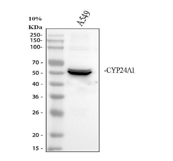 pb9547 cyp24a1 primary antibodies wb testing 1