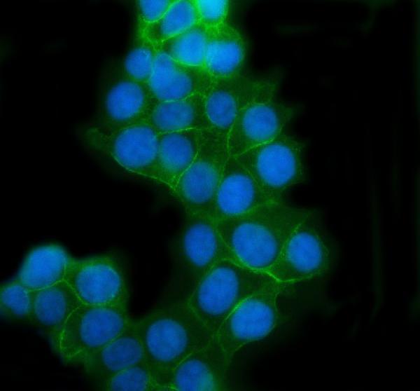 pb9561 cdh1 primary antibodies if testing 1