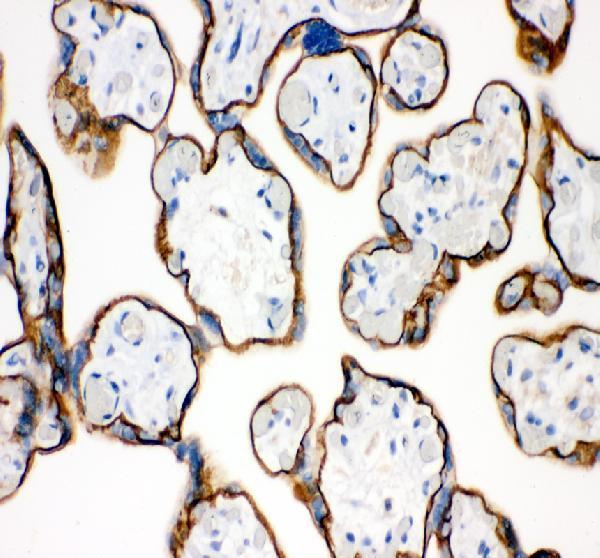 pb9561 cdh1 primary antibodies ihc testing 1