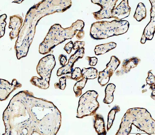 pb9561 cdh1 primary antibodies ihc testing 2