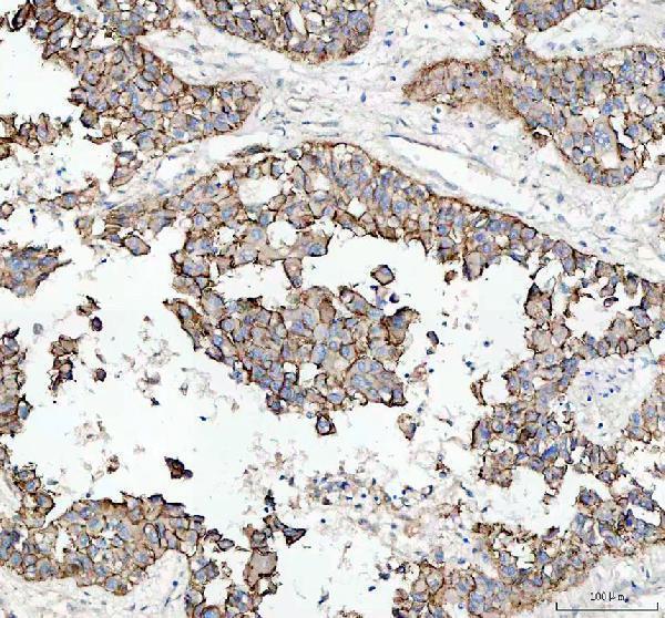 pb9561 cdh1 primary antibodies ihc testing 3