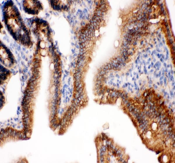 pb9561 cdh1 primary antibodies ihc testing 4