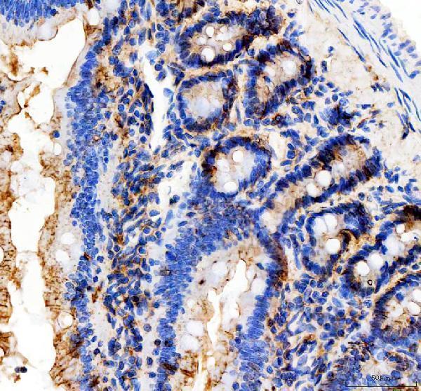 pb9561 cdh1 primary antibodies ihc testing 5