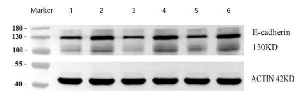 pb9561 cdh1 primary antibodies wb review 1