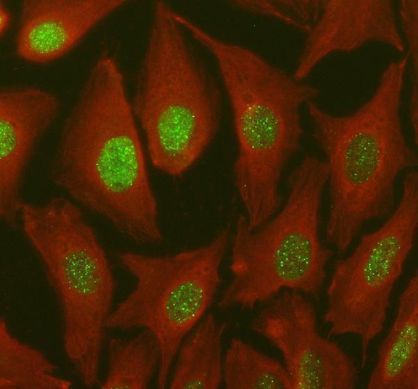 pb9564 csta primary antibodies if testing 1