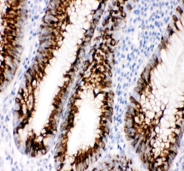 pb9569 ccl11 primary antibodies ihc testing 1