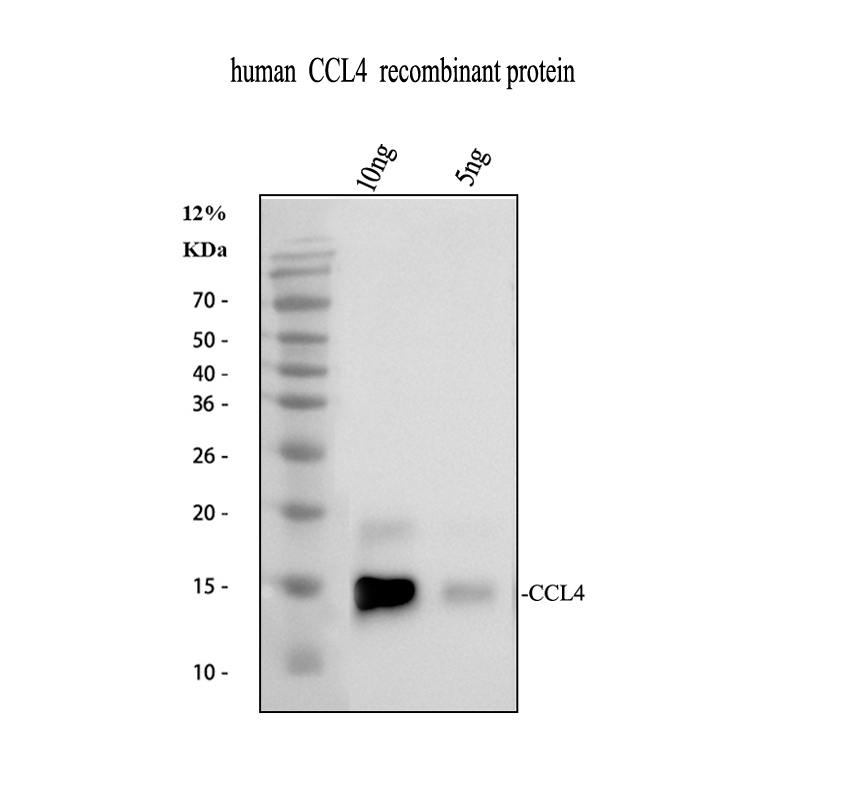 pb9572 ccl4 primary antibodies wb testing 2