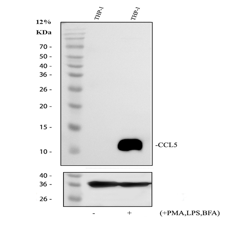 pb9573 ccl5 primary antibodies wb testing 1