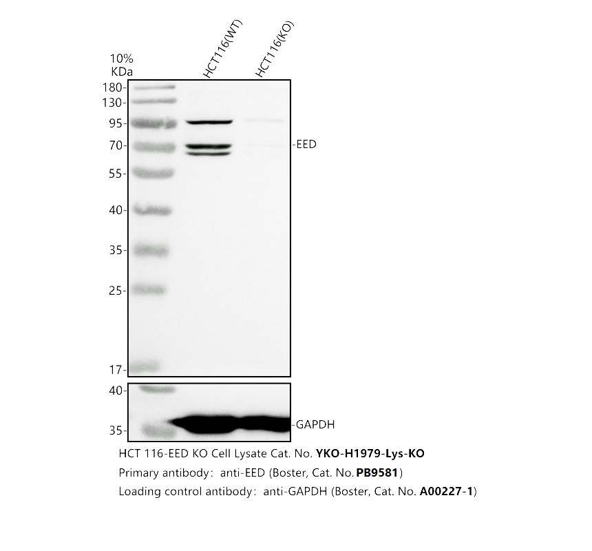 Western blot analysis of EED using anti-EED antibody (PB9581)