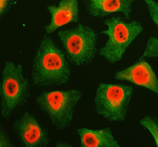pb9585 ewsr1 primary antibodies if testing 1