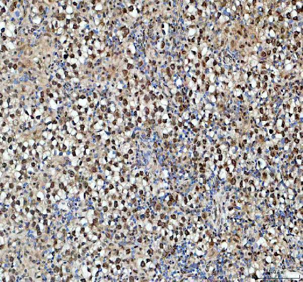 pb9585 ewsr1 primary antibodies ihc testing 1