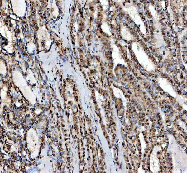 pb9585 ewsr1 primary antibodies ihc testing 2