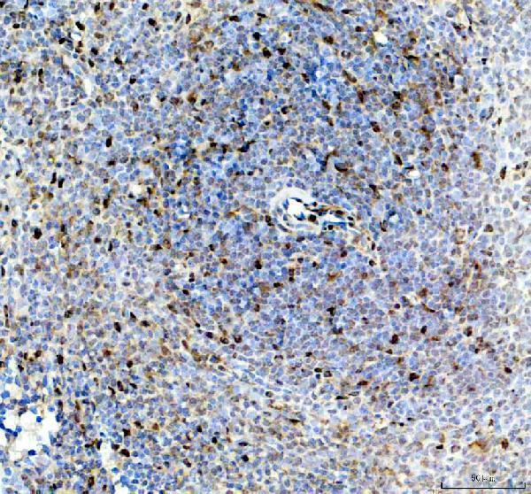 pb9585 ewsr1 primary antibodies ihc testing 3