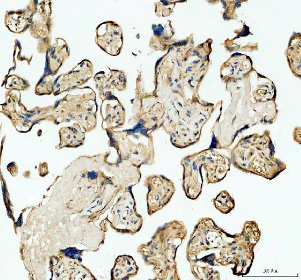 IHC analysis of FZD1 using anti-FZD1 antibody (PB9594)