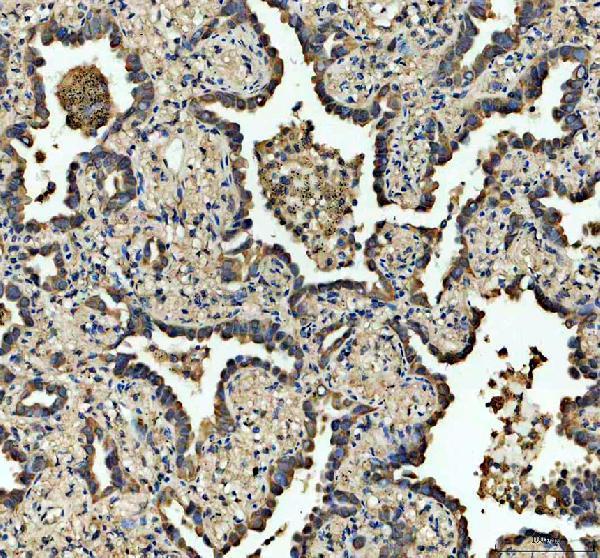 IHC analysis of FZD1 using anti-FZD1 antibody (PB9594)